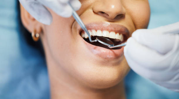 Best Urgent Care for Lost Fillings or Crowns in Hden Springs, ID